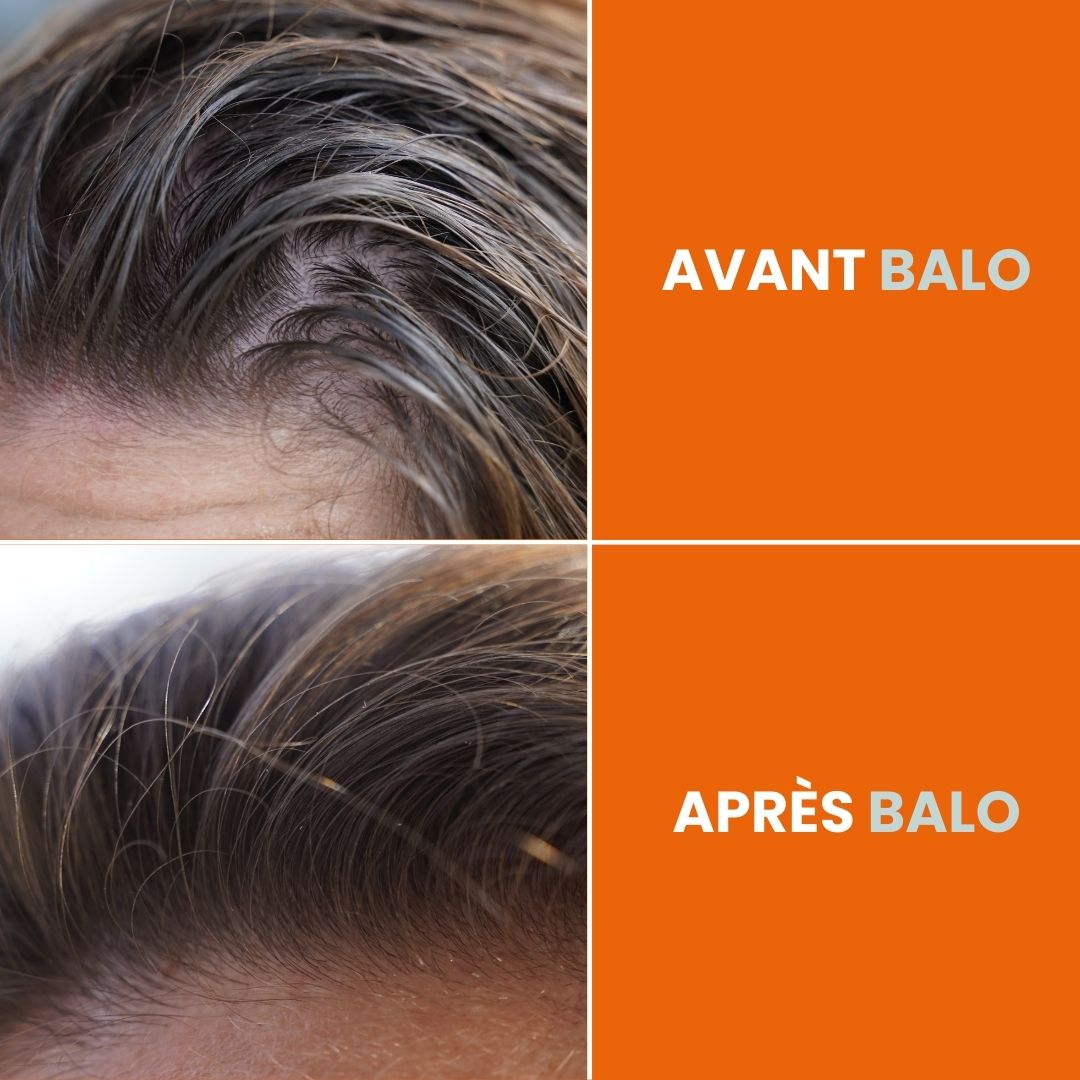 Shampoing sans rinçage - 100ml